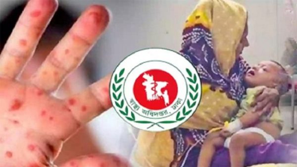 দেশে হাম ও হামের উপসর্গে আরও ৪ শিশুর মৃত্যু