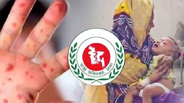 দেশে হাম ও উপসর্গে আরও ৫ শিশুর মৃত্যু