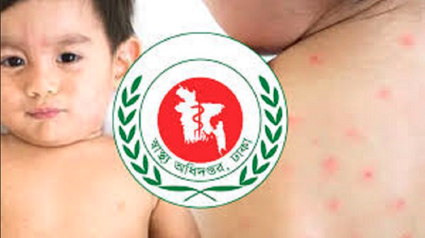 হাম ও হামের উপসর্গ নিয়ে আরও ৫ জনের মৃত্যু, নতুন আক্রান্ত ১১১৫