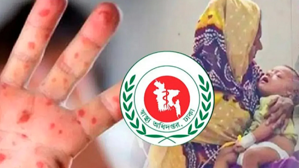 সারাদেশে হাম ও উপসর্গে আরো ১৩ শিশুর মৃত্যু