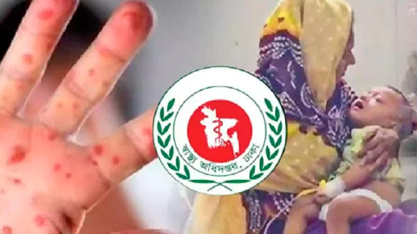 হাম ও উপসর্গে আরও ৬ শিশুর মৃত্যু, মোট প্রাণহানি ৪১৫