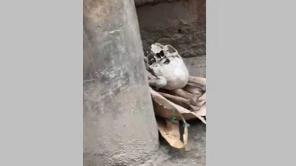 মোহাম্মদপুরে সড়ক থেকে মানুষের মাথার খুলি ও হাড় উদ্ধার