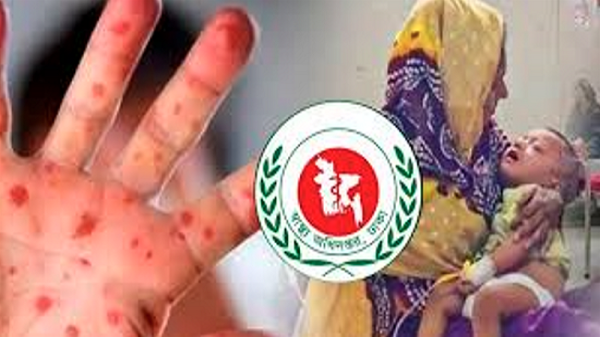 হাম ও উপসর্গে আরও ৪ শিশুর মৃত্যু