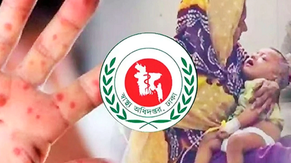 দেশে হাম ও উপসর্গ নিয়ে মৃত্যু ৭০০ ছাড়ালো