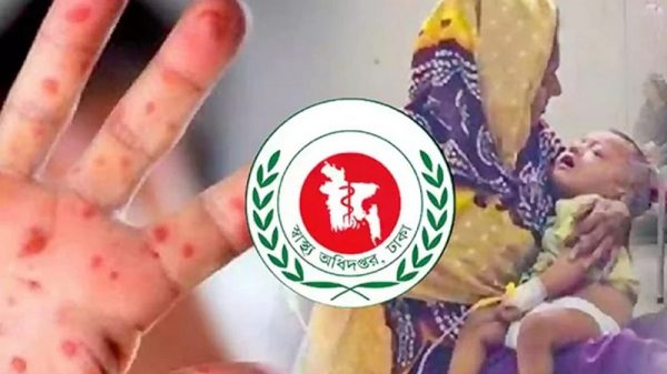 হাম ও উপসর্গে আরও ৩ শিশুর মৃত্যু