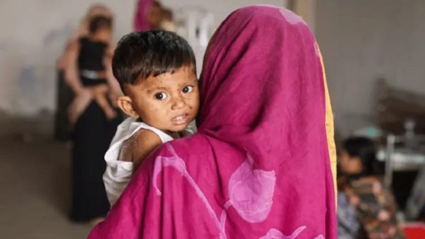 ২৪ ঘণ্টায় হাম উপসর্গে ৫ জনের মৃত্যু, নতুন আক্রান্ত ১০২৫