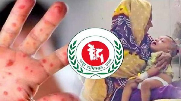 দেশে হামের উপসর্গে আরও ৩ শিশুর মৃত্যু